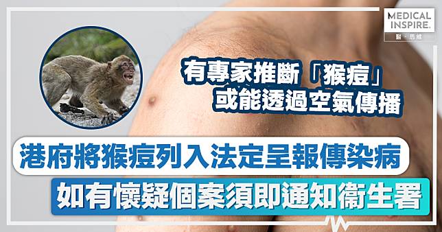 猴痘｜港府將猴痘列入法定呈報傳染病　如有懷疑個案須即通知衞生署