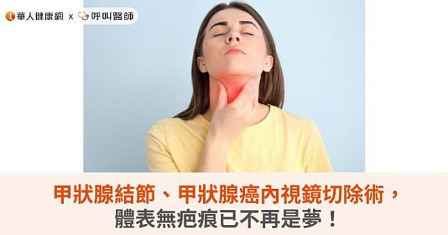 甲狀腺結節、甲狀腺癌內視鏡切除術，體表無疤痕已不再是夢！