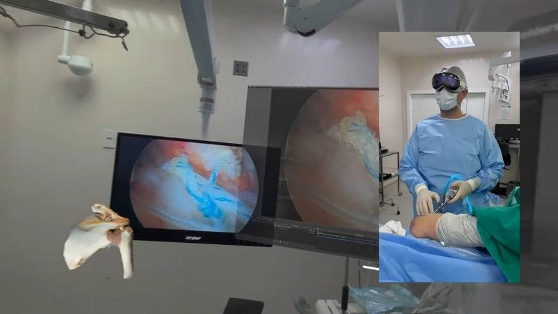 Brazilian Surgeon Successfully Performs Arthroscopic Shoulder Surgery Using Apple Vision Pro: Watch Video Here