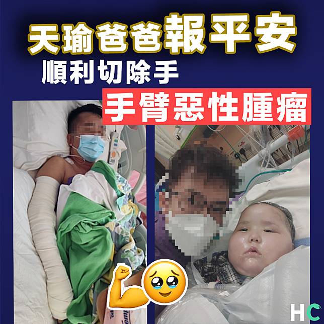 【惡性腫瘤】天瑜爸爸順利切除手臂惡性腫瘤  醫生：電療效果理想