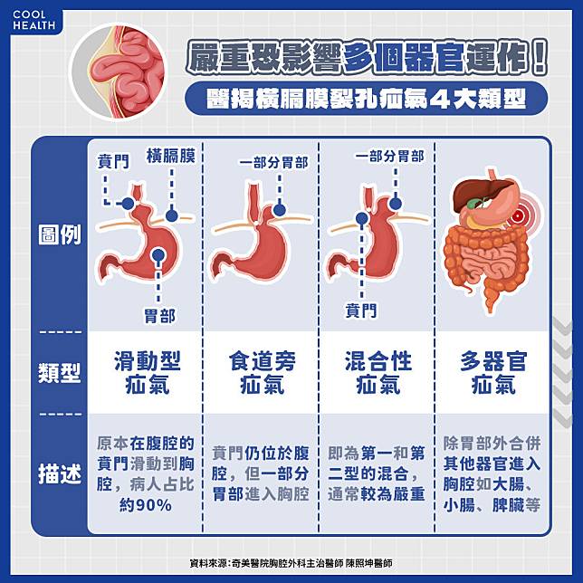 最多影響5個器官運作！ 醫揭「橫膈膜裂孔疝氣」四大類型