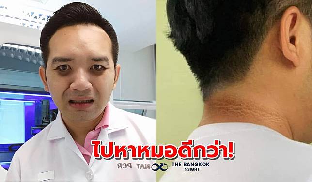 ‘หมอแล็บแพนด้า’ เตือน! คอดำแบบนี้อาจไม่ใช่ขี้ไคล แนะรีบไปหาหมอด่วน!