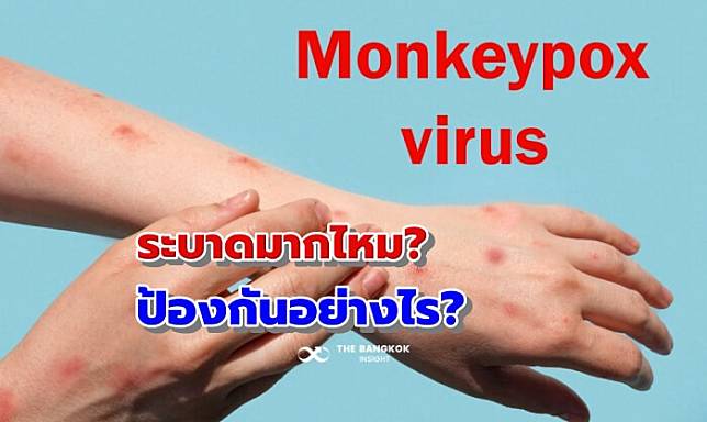 หมอยง ตอบคำถามยอดฮิต ‘ฝีดาษลิง’ จะระบาดมากไหม? และจะป้องกันอย่างไร