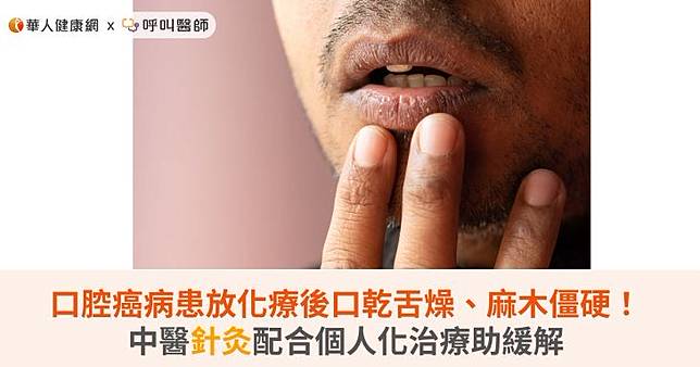 口腔癌病患放化療後口乾舌燥、麻木僵硬！中醫針灸配合個人化治療助緩解
