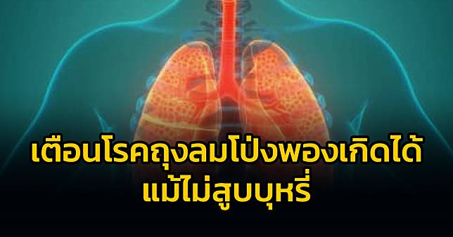 กรมการแพทย์เตือนโรคถุงลมโป่งพองเกิดได้ แม้ไม่สูบบุหรี่