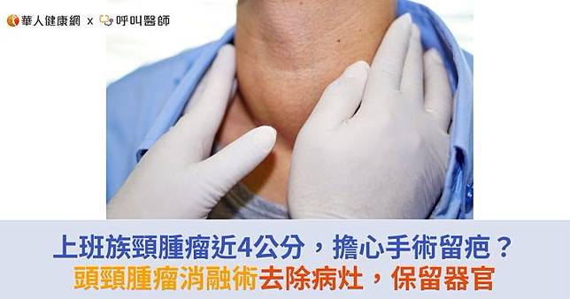 上班族頸腫瘤近4公分，擔心手術留疤？頭頸腫瘤消融術去除病灶，保留器官