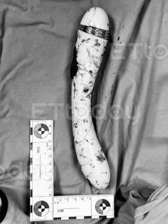 แท่งนวดขนาดกว่า 20 เซนติเมตร ยังสั่นแรงไฟฟ้าเต็มพิกัด ค้างในร่างกายชายหนุ่มทั้งคืน (ภาพ: คุณหมอเฉิน จื้ออี๋)