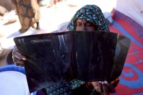 2025年11月22日，查德東部的臨時難民營中，逃離蘇丹法舍的62歲穆斯塔法展示她的X光片，她體內還有一枚子彈，但沒有錢手術取出。路透社