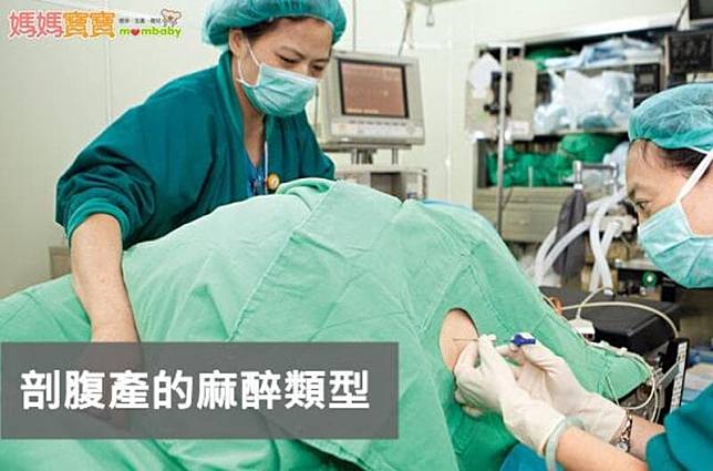 剖腹產麻醉類型