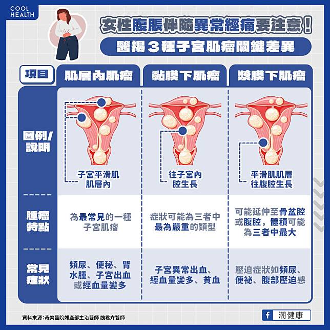 女性腹部「異常凸起」不一定是懷孕！  她檢查後嚇傻：肚皮下竟藏「18公分肌瘤」