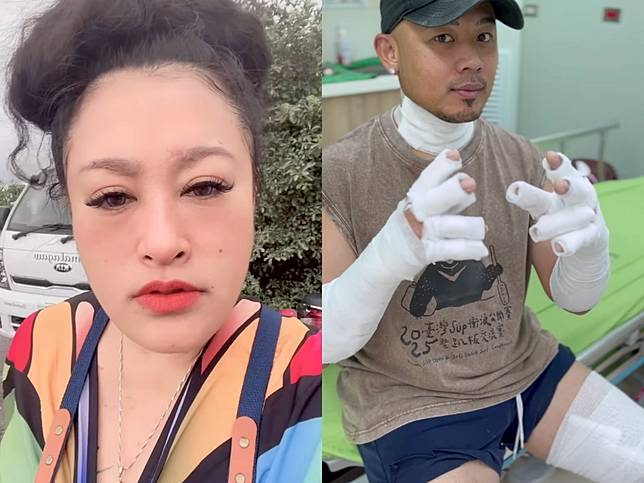 紀曉君台東賣小吃！老公慘遇氣爆二度燒傷全身纏紗布