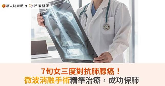 7旬女三度對抗肺腺癌！微波消融手術精準治療，成功保肺