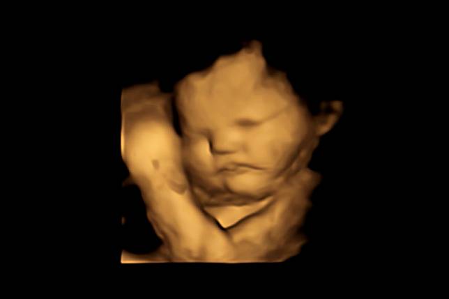 國際期刊《心理學》最新研究指出，羽衣甘藍的味道讓胎兒做出鬼臉（翻攝自journals.sagepub.com）