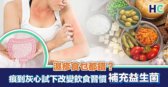 HC健康迷思 ｜濕疹食乜都錯？痕到灰心試下改變飲食習慣補充益生菌