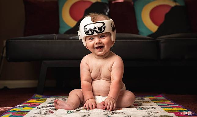 怕寶寶頭型不夠圓，媽媽訂製頭盔戴3個月後悲劇了！