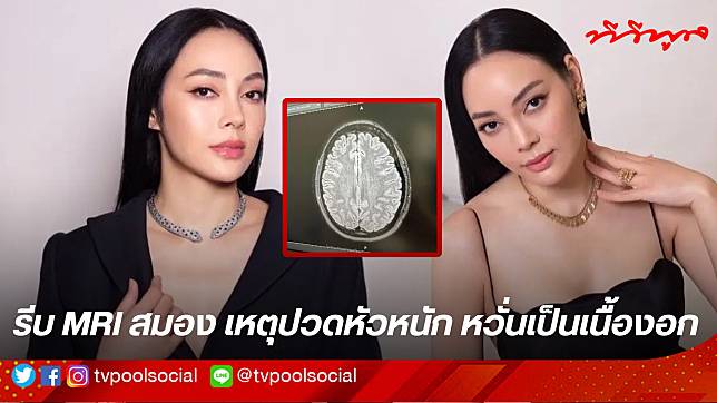 “ตั๊ก บงกช” รีบ MRI สมอง เหตุปวดหัวหนัก หวั่นเป็นเนื้องอก