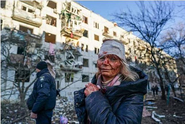 遭戰火波及而受傷的烏克蘭首都基輔市民。(twitter@SESU_UA)