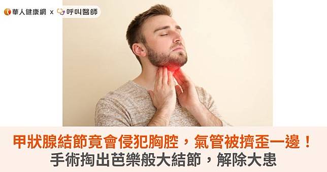甲狀腺結節竟會侵犯胸腔，氣管被擠歪一邊！手術掏出芭樂般大結節，解除大患