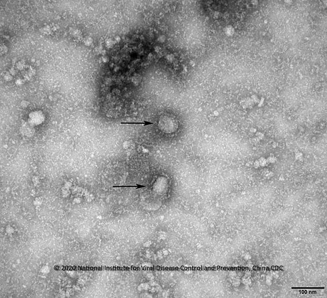本港多3人確診感染新型冠狀病毒令累計病例增至65宗(資料圖片)