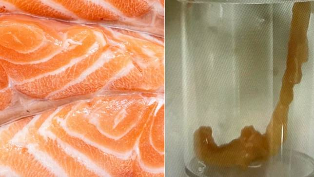 一名愛吃鮭魚生魚片的女童，排便拉出一隻還在蠕動的蟲。資料照片、翻攝Dr. E 小兒急診室日誌臉書