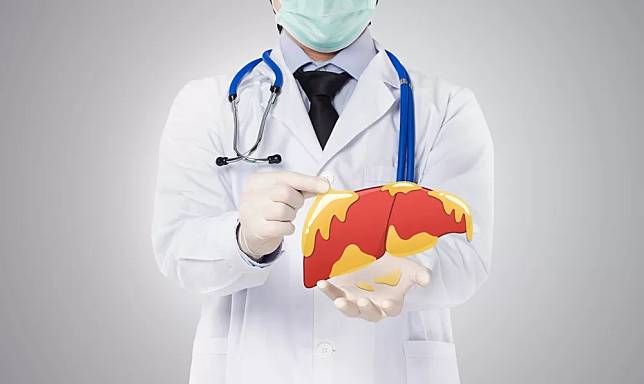 Doctor,Showing,Fatty,Liver,,,Liver,Disease,In,White,Background