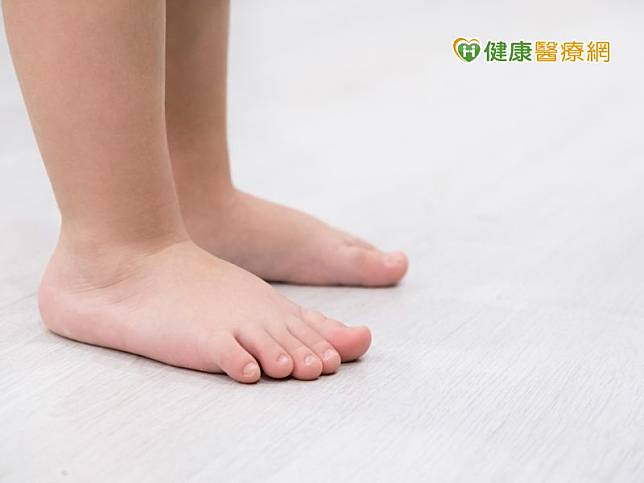 扁平足就是足弓低下或沒有足弓，缺乏了避震功能，所以在走路或運動時容易累、痛。