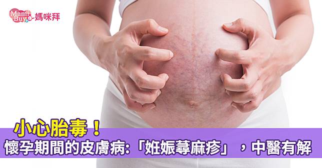 小心胎毒！懷孕期間的皮膚病：「姙娠蕁麻疹」，中醫有解