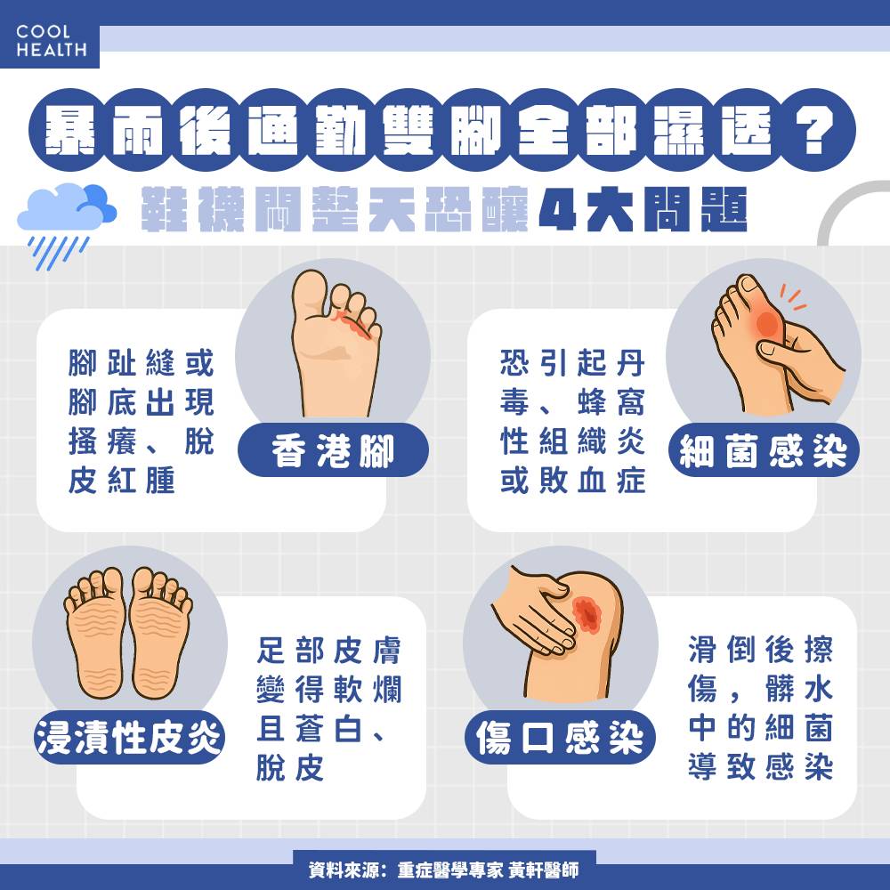 暴雨後雙腳發癢、脫皮？ 醫揭關鍵4步驟幫助鞋襪快乾| 潮健康| LINE TODAY
