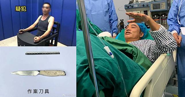 華哥接受手術後情況穩定，正返港接受治療。53歲陳姓疑犯接受醫院診斷，初步被指患有妄想症。（網上圖片  / 明報製圖）