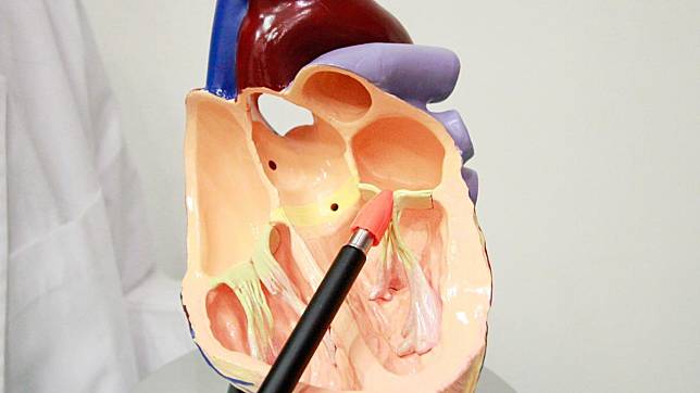心臟惡性軟組織肉瘤罕見。(圖／醫院提供）