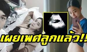 ดูกันชัดๆ “นิวเคลียร์” เผยผลอัลตราซาวด์เพศลูกแล้ว!! (มีคลิป)