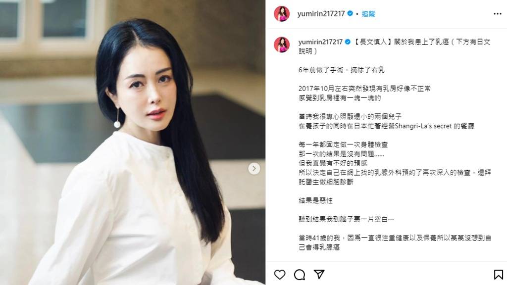 The actress “Kangxi” revealed that she was affected by breast most cancers and cried each day!  Make “one therapy” like Second Life and begin displaying medical survival charge |  Well being 2.0 |