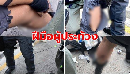 ตำรวจฮ่องกงเจอผู้ประท้วงยิงธนูใส่ได้รับบาดเจ็บ