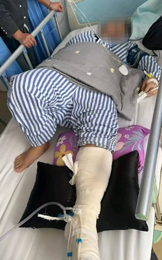 中國一名30歲女子邊滑手機邊充電，全身觸電險些喪命。圖／翻攝自微博