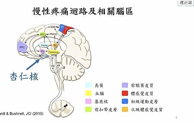 研究團隊發現，慢性肌痛症小鼠杏仁核中央區的神經迴路變化，可同時解釋症狀與治療，最新研究今登上國際期刊。(研究團隊提供)