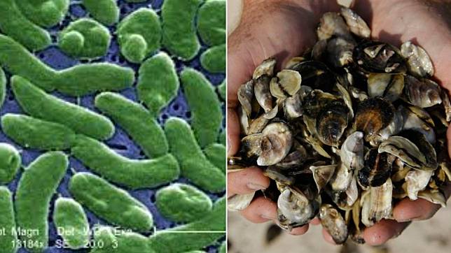 美國東岸傳出多起感染「創傷弧菌」致死的案例。（圖／翻攝自Twitter@P_F_Lherisson_）