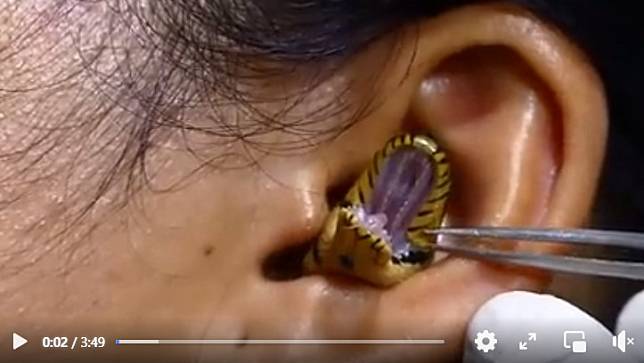 印度網友Chandan Singh上傳一部影片，一條蛇疑似鑽進女子的耳朵裡。   圖：翻攝自Chandan Singh臉書