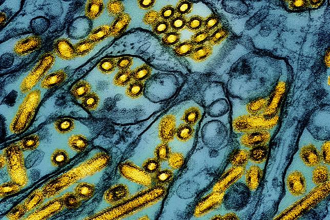 美國國家過敏與傳染病研究院3月26日提供H5N1病毒顯微鏡圖。（美聯社）