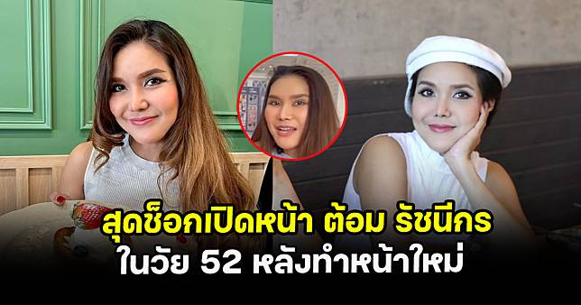 สุดช็อกเปิดหน้า ต้อม รัชนีกร ในวัย 52 หลังทำหน้าใหม่