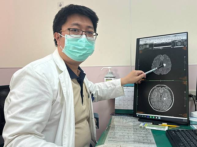 李綜合醫院神經內科主治醫師張峻誠指出，一名患者亂服藥導致左腦阻塞。 （記者陳榮昌攝）