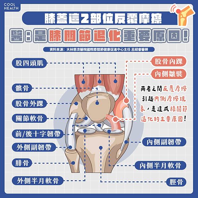 名醫揭膝關節退化真相！ 「2部位」反覆摩擦是重要原因