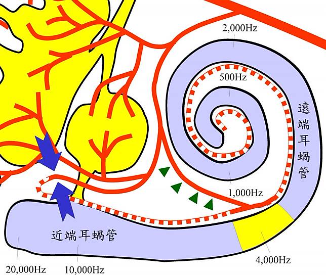 醫師陳建志說，前方耳蝸動脈缺血（藍箭頭處）致整段耳蝸受影響（淡紫色區），僅4000 Hz處功能被保留，是因接受後方耳蝸動脈支援（綠箭頭處）。（醫師陳建志提供）