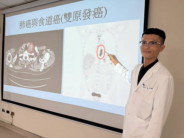 衛生福利部臺中醫院肝膽腸胃科吳明駿醫師指著患者發現食道癌的部位，說明與肺癌復發（左圖）、雙癌同時出現的情況。（圖／臺中醫院）