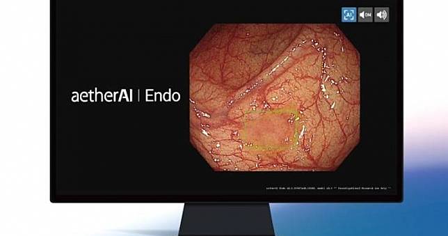 國內首項「大腸鏡即時AI瘜肉偵測」獲認證　準確度高達95%