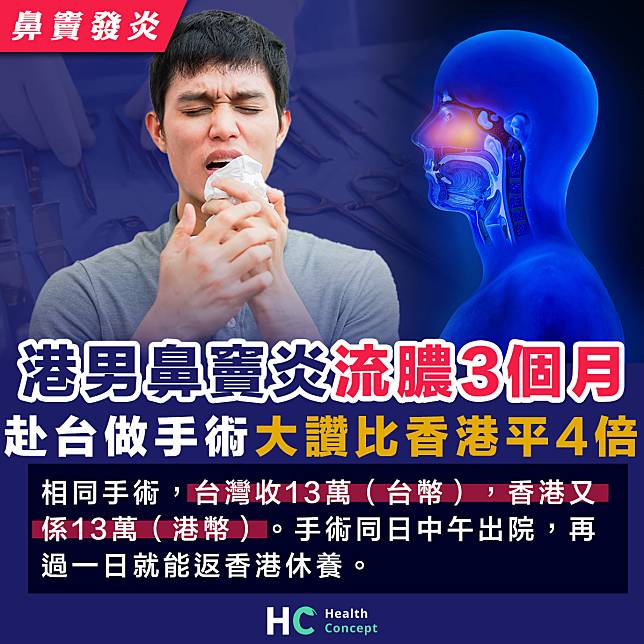 【鼻竇發炎】港男鼻竇炎流膿3個月 赴台灣做手術大讚比香港平4倍