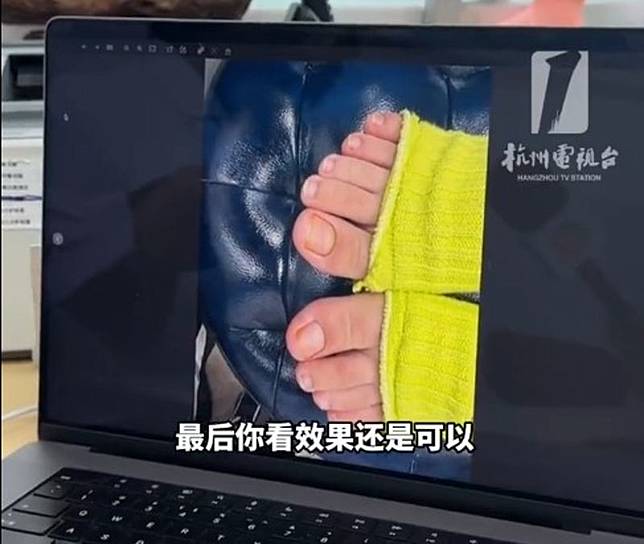 醫師建議若想穿著襪子睡覺，可以將襪子前方剪掉，讓腳趾外露。圖／翻攝自微博／三農頻道