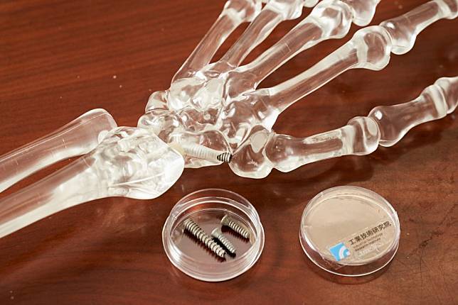 銀牌獎「促進組織整合仿生3D列印技術」以積層製造（3D列印），打造出「仿生中空骨釘」，可透過模擬、設計與製程管控，製作不同規格、多孔隙的骨釘、椎間融合器等植入骨材為智慧醫療提供助力。（工研院提供）