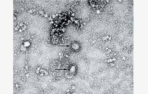 中國疾病預防中心今（24）日在官網上公布首株新型冠狀病毒顯微鏡照片。   圖：取自中國疾病預防中心官網