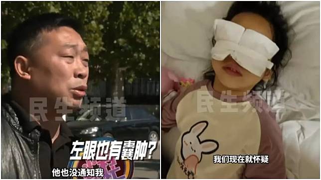 河南4歲女童右眼切除囊腫，不料後來醫生未先告知家屬就連左眼一起動刀。（圖／翻攝微博）