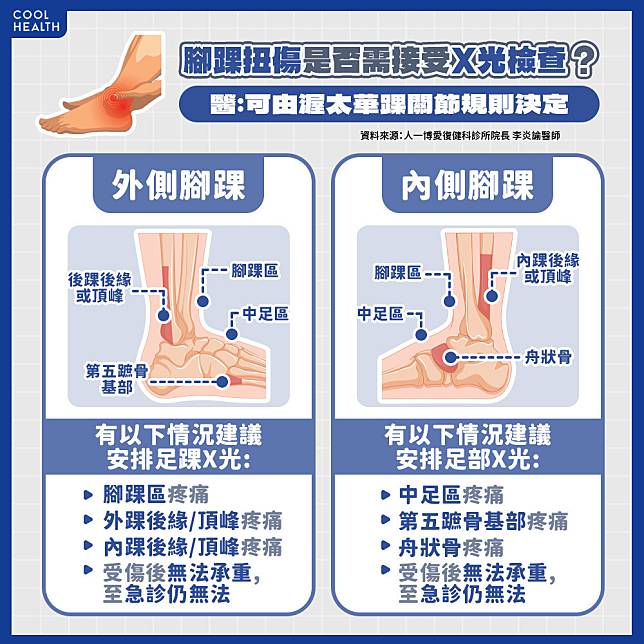 「檢測陽性」不代表有骨折？ 醫曝：受傷後「無法承重」要注意！